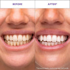 Whitening Strips, 7-Day Treatment (7 Packets - 2 Strips per Pack)- Enamel-Safe Strips for Sensitive Teeth - Non-Slip, Dry Strip