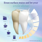 Whitening Strips, 7-Day Treatment (7 Packets - 2 Strips per Pack)- Enamel-Safe Strips for Sensitive Teeth - Non-Slip, Dry Strip